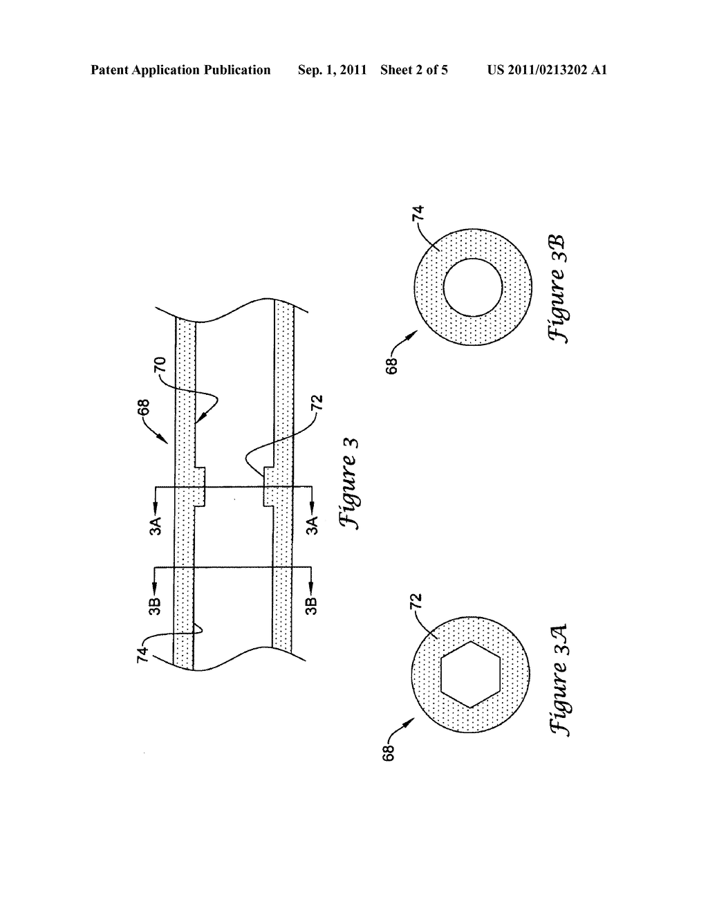 ENDOSCOPE WORKING CHANNEL WITH MULTIPLE FUNCTIONALITY - diagram, schematic, and image 03