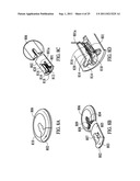 Medical devices and methods diagram and image