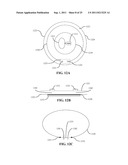 Medical devices and methods diagram and image