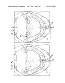 ORAL DEVICE diagram and image