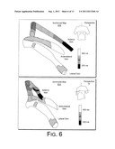 CRT LEAD PLACEMENT BASED ON OPTIMAL BRANCH SELECTION AND OPTIMAL SITE     SELECTION diagram and image