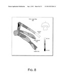 CRT LEAD PLACEMENT BASED ON OPTIMAL BRANCH SELECTION AND OPTIMAL SITE     SELECTION diagram and image