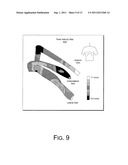 CRT LEAD PLACEMENT BASED ON OPTIMAL BRANCH SELECTION AND OPTIMAL SITE     SELECTION diagram and image