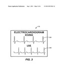 Method for Presenting Current and Stored ECG Waveforms on a Portable,     External Defibrillator diagram and image