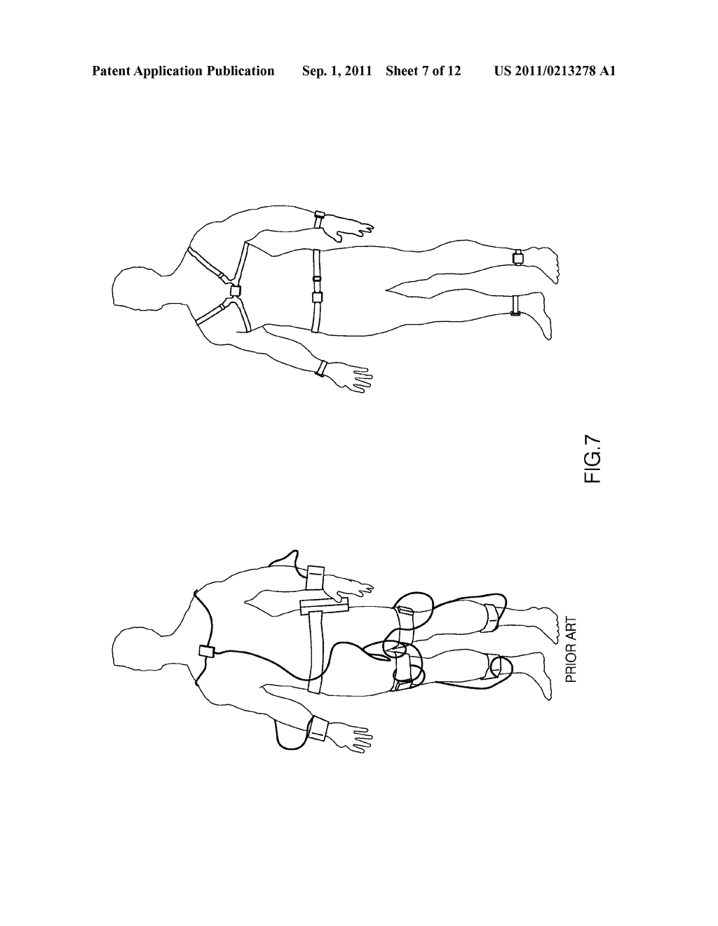 MOVEMENT MONITORING SYSTEM AND APPARATUS FOR OBJECTIVE ASSESSMENT OF     MOVEMENT DISORDERS - diagram, schematic, and image 08