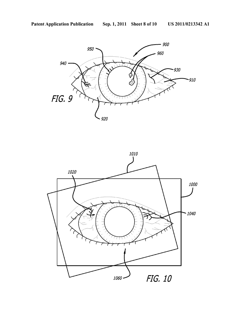 Real-time Virtual Indicium Apparatus and Methods for Guiding an Implant     into an Eye - diagram, schematic, and image 09