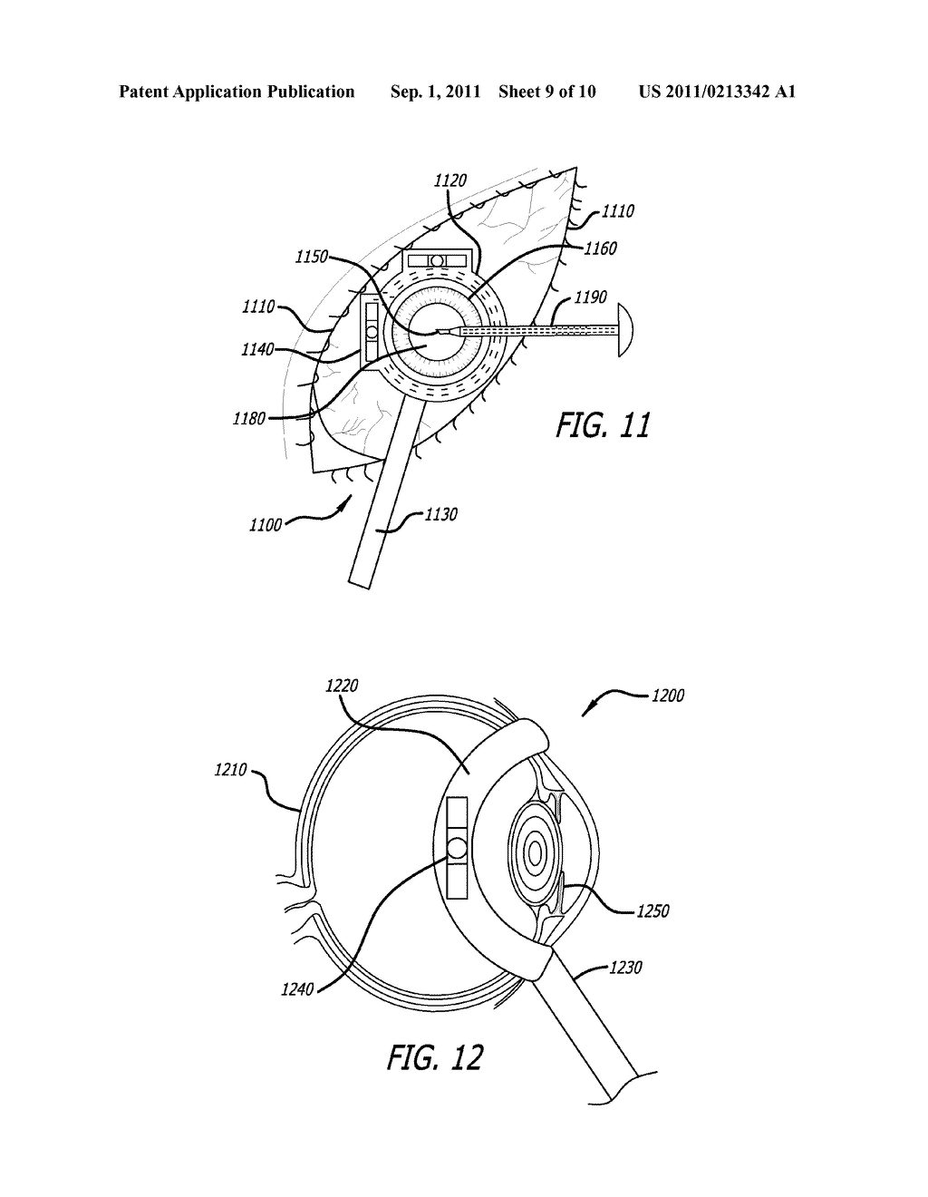 Real-time Virtual Indicium Apparatus and Methods for Guiding an Implant     into an Eye - diagram, schematic, and image 10