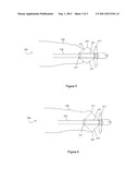 Devices for Handling Catheter Assembly diagram and image