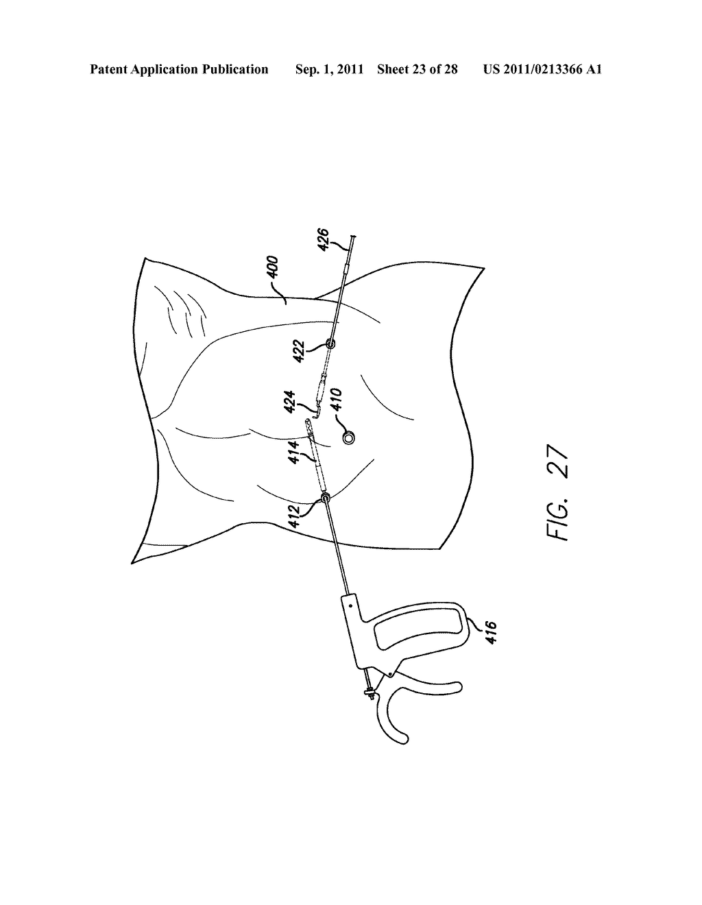 METHOD AND DEVICES FOR PERFORMING MINIMALLY INVASIVE SURGERY - diagram, schematic, and image 24