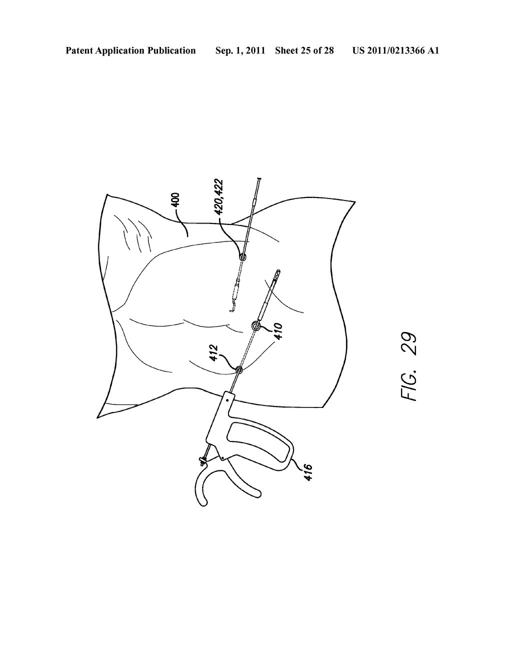 METHOD AND DEVICES FOR PERFORMING MINIMALLY INVASIVE SURGERY - diagram, schematic, and image 26