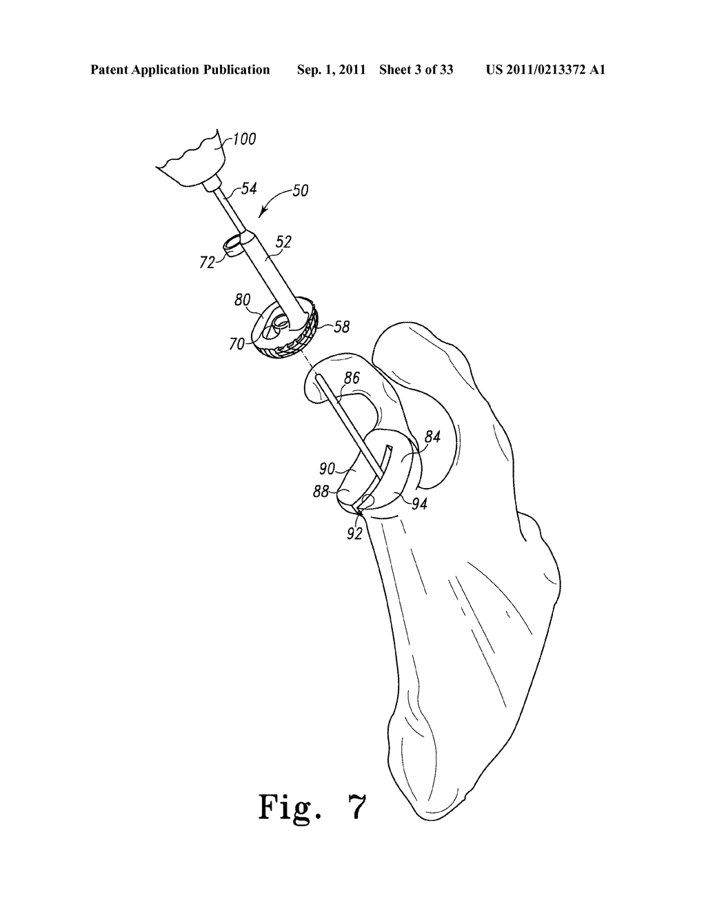 RECIPROCATING RASPS FOR USE IN AN ORTHOPAEDIC SURGICAL PROCEDURE - diagram, schematic, and image 04