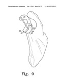 RECIPROCATING RASPS FOR USE IN AN ORTHOPAEDIC SURGICAL PROCEDURE diagram and image