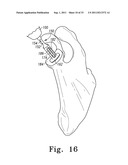 RECIPROCATING RASPS FOR USE IN AN ORTHOPAEDIC SURGICAL PROCEDURE diagram and image