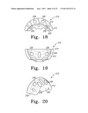 RECIPROCATING RASPS FOR USE IN AN ORTHOPAEDIC SURGICAL PROCEDURE diagram and image