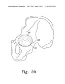 RECIPROCATING RASPS FOR USE IN AN ORTHOPAEDIC SURGICAL PROCEDURE diagram and image