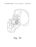 RECIPROCATING RASPS FOR USE IN AN ORTHOPAEDIC SURGICAL PROCEDURE diagram and image