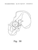 RECIPROCATING RASPS FOR USE IN AN ORTHOPAEDIC SURGICAL PROCEDURE diagram and image