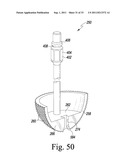 RECIPROCATING RASPS FOR USE IN AN ORTHOPAEDIC SURGICAL PROCEDURE diagram and image