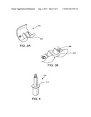 DISTAL FEMORAL TRIAL WITH REMOVABLE CUTTING GUIDE diagram and image