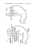 TRANSORAL ENDOSCOPIC GASTROESOPHAGEAL FLAP VALVE RESTORATION DEVICE,     ASSEMBLY, SYSTEM AND METHOD diagram and image