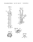 TRANSORAL ENDOSCOPIC GASTROESOPHAGEAL FLAP VALVE RESTORATION DEVICE,     ASSEMBLY, SYSTEM AND METHOD diagram and image