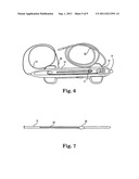 ROTATIONAL ATHERECTOMY DEVICE WITH ELECTRIC MOTOR diagram and image