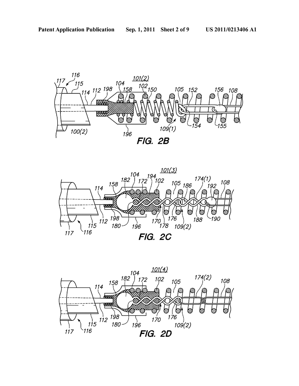 ANCHOR ASSEMBLIES IN STRETCH-RESISTANT VASO-OCCLUSIVE COILS - diagram, schematic, and image 03