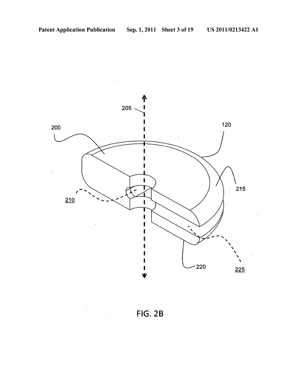 ORTHOPEDIC FIXATION ASSEMBLY AND METHOD OF USE - diagram, schematic, and image 04