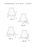 Patient Selectable Joint Arthroplasty Devices and Surgical Tools diagram and image