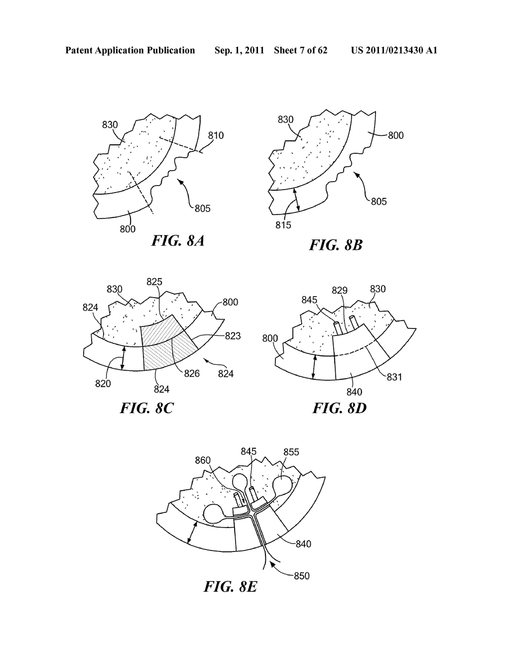 Patient Selectable Joint Arthroplasty Devices and Surgical Tools - diagram, schematic, and image 08