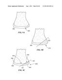 Patient Selectable Joint Arthroplasty Devices and Surgical Tools diagram and image