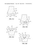 Patient Selectable Joint Arthroplasty Devices and Surgical Tools diagram and image