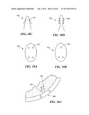 Patient Selectable Joint Arthroplasty Devices and Surgical Tools diagram and image