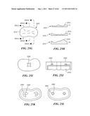 Patient Selectable Joint Arthroplasty Devices and Surgical Tools diagram and image