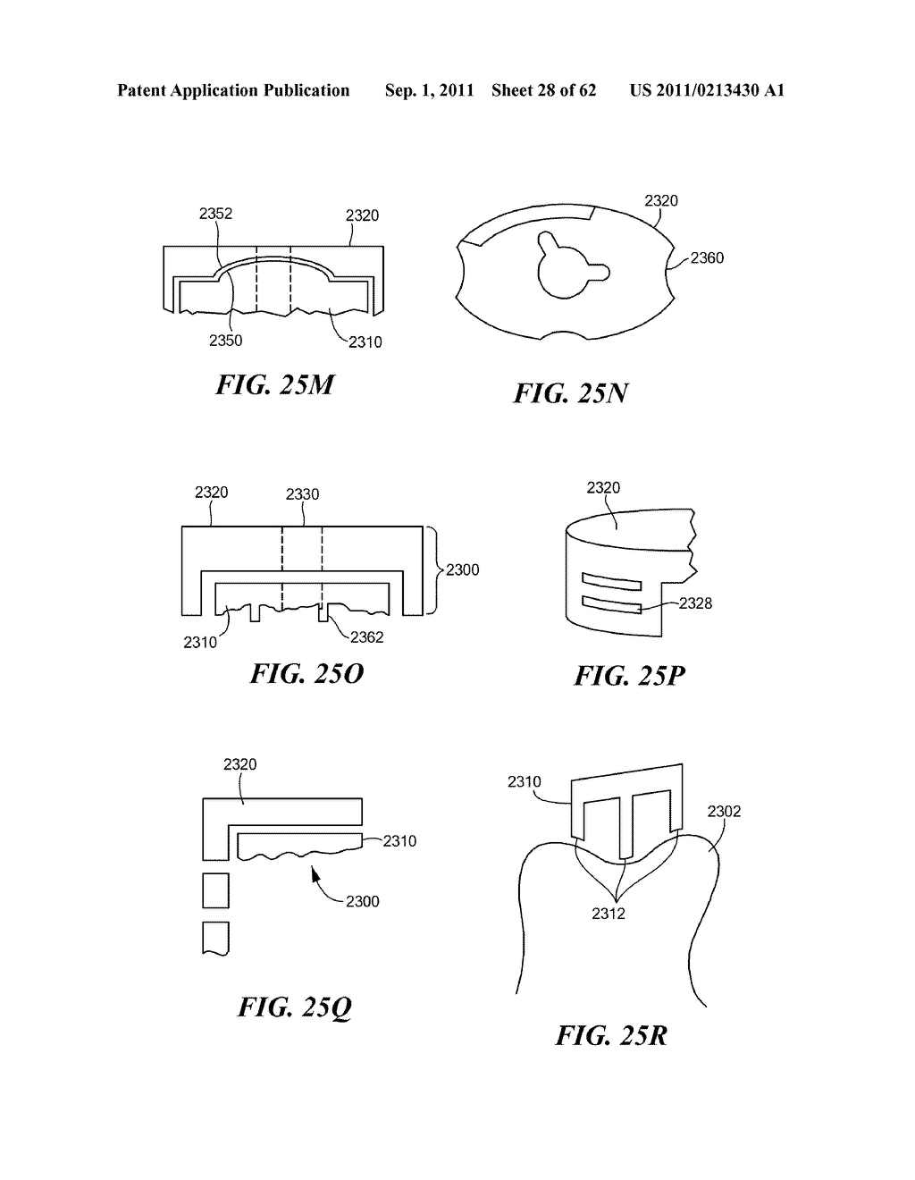 Patient Selectable Joint Arthroplasty Devices and Surgical Tools - diagram, schematic, and image 29