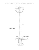 Patient Selectable Joint Arthroplasty Devices and Surgical Tools diagram and image