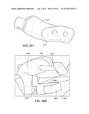 Patient Selectable Joint Arthroplasty Devices and Surgical Tools diagram and image