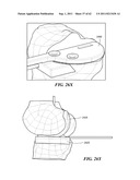 Patient Selectable Joint Arthroplasty Devices and Surgical Tools diagram and image