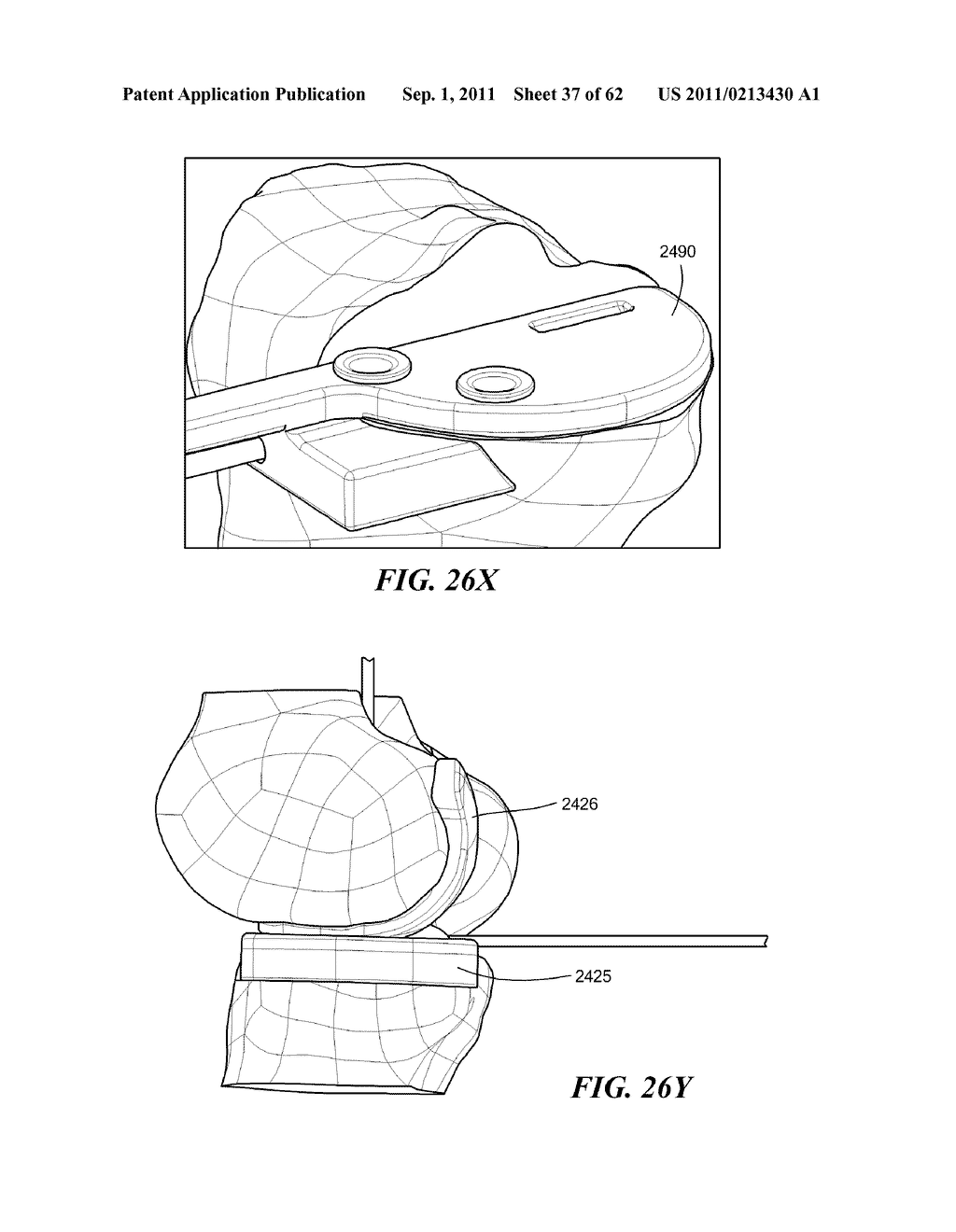 Patient Selectable Joint Arthroplasty Devices and Surgical Tools - diagram, schematic, and image 38