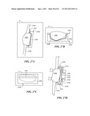 Patient Selectable Joint Arthroplasty Devices and Surgical Tools diagram and image