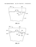 Patient Selectable Joint Arthroplasty Devices and Surgical Tools diagram and image