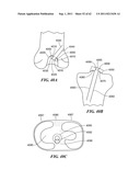 Patient Selectable Joint Arthroplasty Devices and Surgical Tools diagram and image