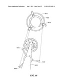 Patient Selectable Joint Arthroplasty Devices and Surgical Tools diagram and image