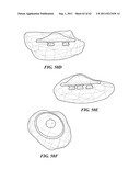 Patient Selectable Joint Arthroplasty Devices and Surgical Tools diagram and image