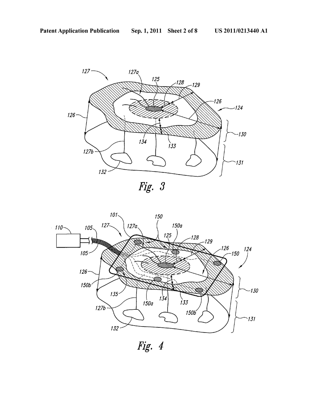 ELECTROMAGNETIC SIGNAL DELIVERY FOR TISSUE AFFECTED BY NEURONAL     DYSFUNCTION, DEGRADATION, DAMAGE, AND/OR NECROSIS, AND ASSOCIATED SYSTEMS     AND METHODS - diagram, schematic, and image 03