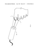 Fungal Infection Therapy with Low Level Laser diagram and image