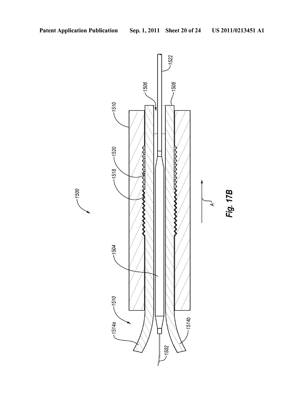 MEDICAL DEVICE SHIELD AND METHODS FOR DELIVERING A MEDICAL DEVICE - diagram, schematic, and image 21