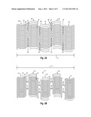 STENT GRAFT diagram and image