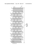 STENT GRAFT diagram and image