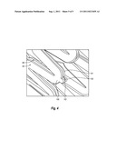 STENT GRAFT diagram and image